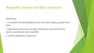 Surgically assisted maxillary expansion
Indications
1. A skeletal maxillomandibular transverse discrepancy greater than
5mm .
2. Significant transverse maxillary deficiency associated with a
narrow maxilla and wide mandible;
3. Failed orthodontic expansion.
 