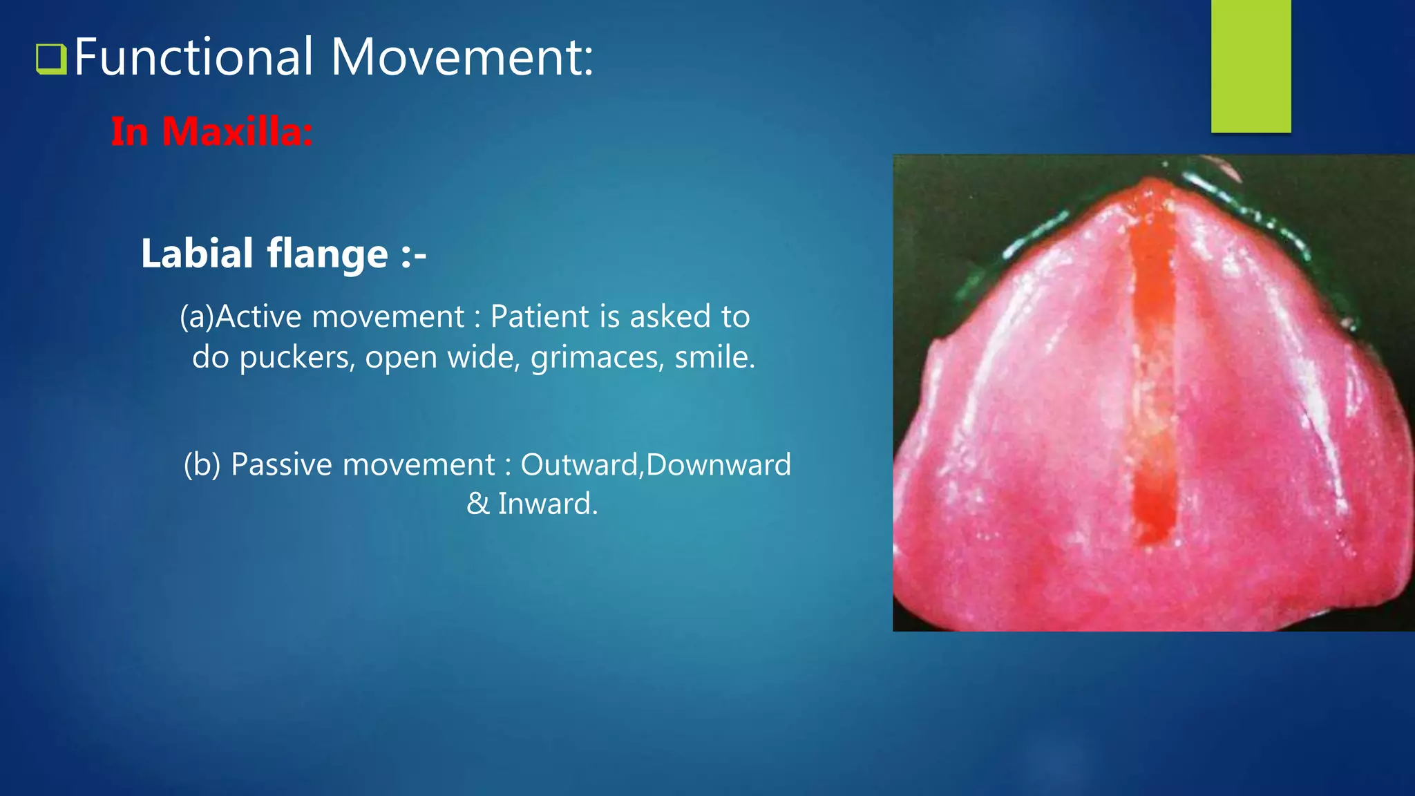 Border Moulding in Complete Denture Prosthesis PPT