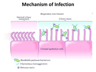 Mechanism of Infection
 
