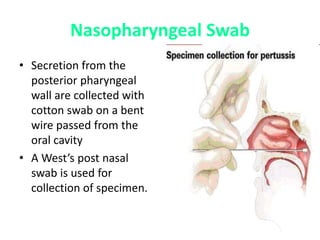 Nasopharyngeal Swab
• Secretion from the
posterior pharyngeal
wall are collected with
cotton swab on a bent
wire passed from the
oral cavity
• A West’s post nasal
swab is used for
collection of specimen.
 