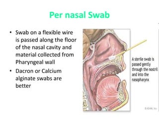 Per nasal Swab
• Swab on a flexible wire
is passed along the floor
of the nasal cavity and
material collected from
Pharyngeal wall
• Dacron or Calcium
alginate swabs are
better
 