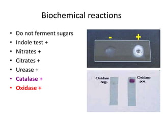 Biochemical reactions
• Do not ferment sugars
• Indole test +
• Nitrates +
• Citrates +
• Urease +
• Catalase +
• Oxidase +
 