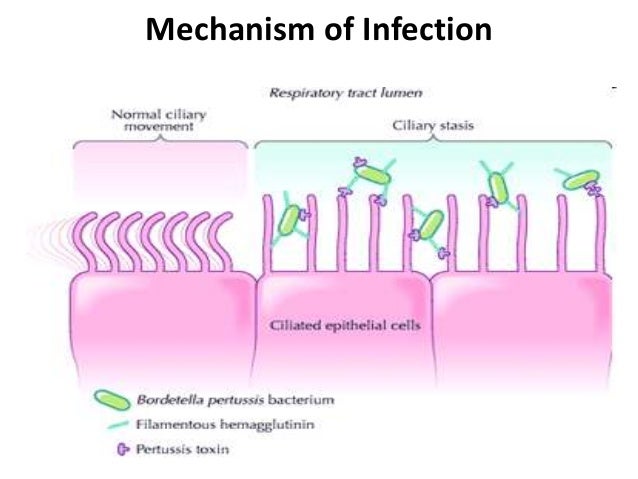 Bordetella bordetella diagram 