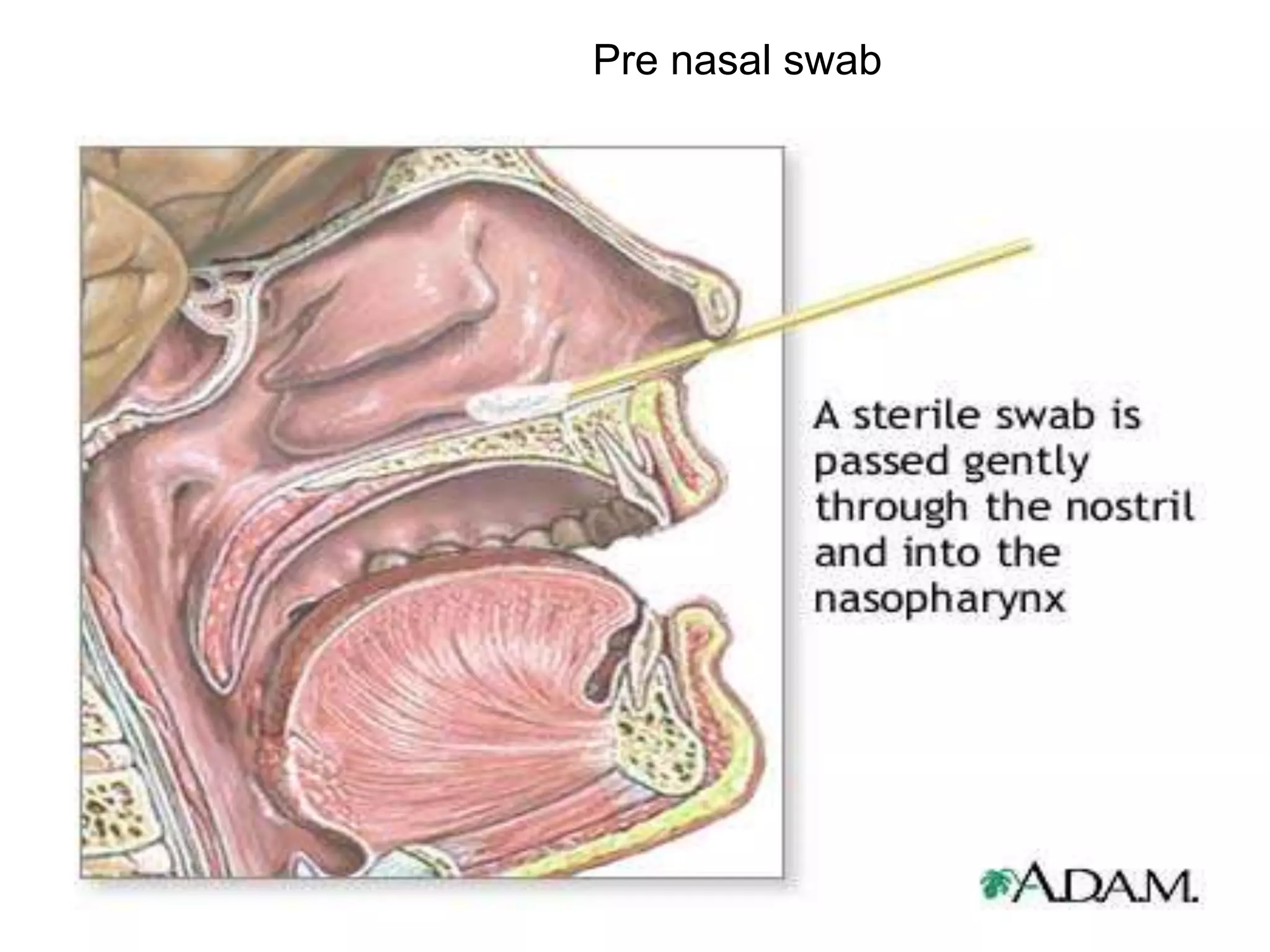 Pre nasal swab
 