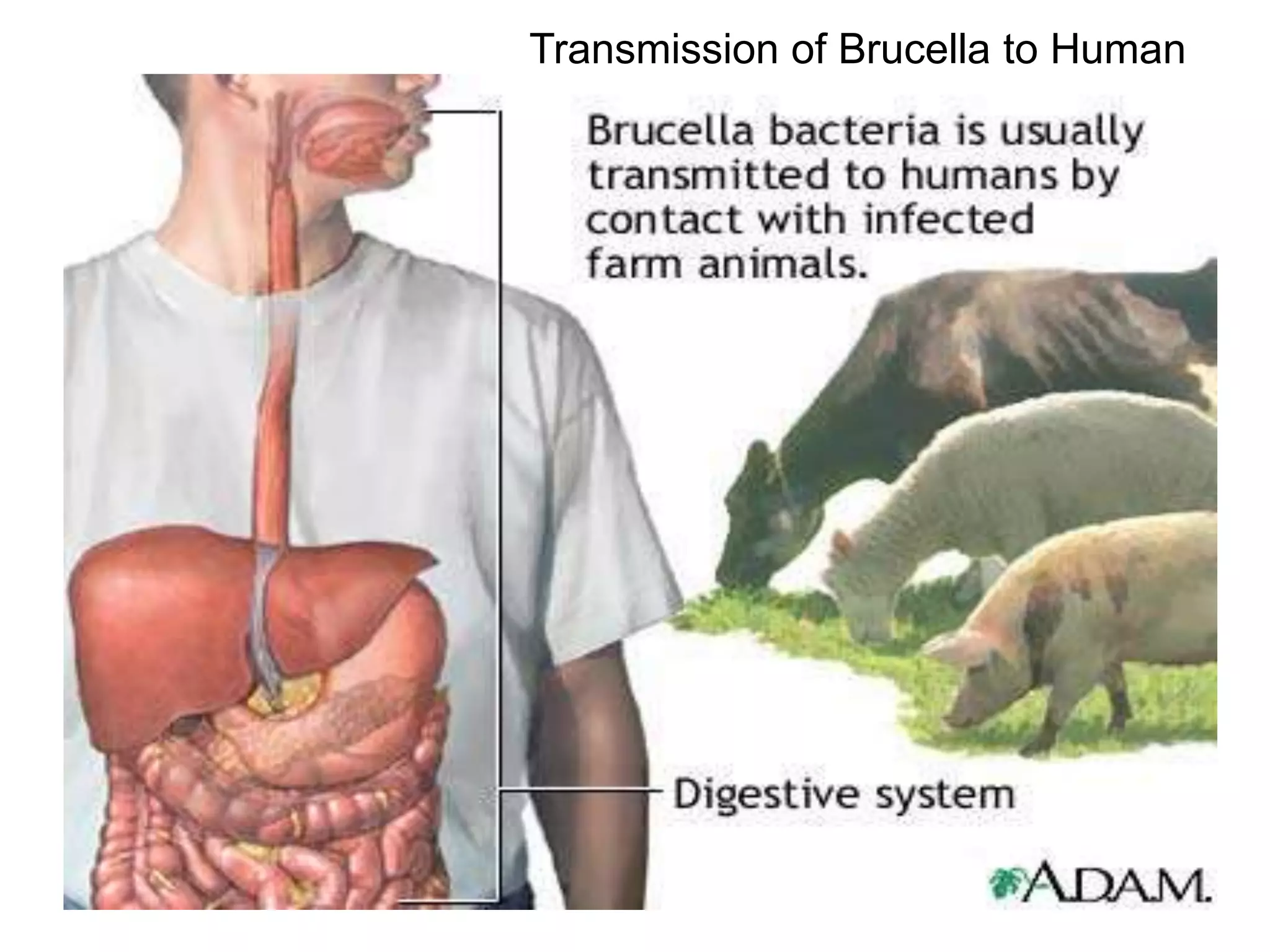 Transmission of Brucella to Human
 