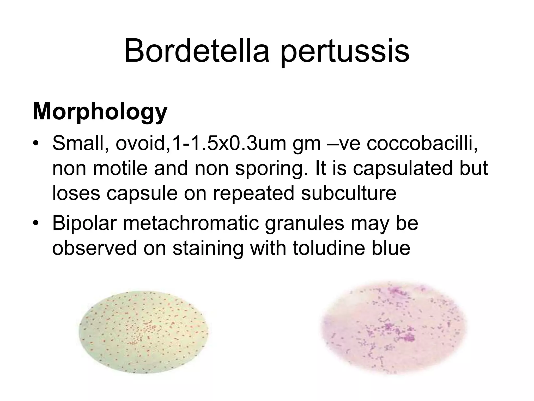 Bordetella pertussis
Morphology
• Small, ovoid,1-1.5x0.3um gm –ve coccobacilli,
non motile and non sporing. It is capsulated but
loses capsule on repeated subculture
• Bipolar metachromatic granules may be
observed on staining with toludine blue
 