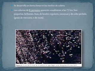  Se desarrolla en forma lenta en los medios de cultivo. 
 Las colonias de B. pertussis aparecen usualmente a las 72 hrs. Son 
pequeñas, brillantes, lisas, de bordes regulares, convexas y de color perlado, 
(gotas de mercurio, o de rocío). 
 