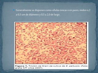  Generalmente se disponen como células únicas o en pares, miden o,2 
a 0,5 um de diámetro y 0,5 a 2,0 de largo. 
 