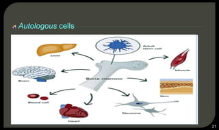 Autologous cells
21
 