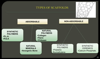 31
ABSORBABLE NON-ABSORBABLE
SYNTHETIC
POLYMERS
•P.L.A.
•P.G.A
NATURAL
MINERALS
•Anorganic Bone
NATURAL
POLYMERS
•Collagen
•Fibrin
•Chitosan
SYNTHETIC
CEREMICS
•Calcium Phosphate
SYNTHETIC
POLYMERS
•Polytetra
flouroethylene
 