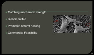 Matching mechanical strength
 Biocompatible
 Promotes natural healing
 Commercial Feasibility
39
 