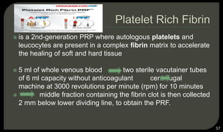  is a 2nd-generation PRP where autologous platelets and
leucocytes are present in a complex fibrin matrix to accelerate
the healing of soft and hard tissue
 5 ml of whole venous blood two sterile vacutainer tubes
of 6 ml capacity without anticoagulant centrifugal
machine at 3000 revolutions per minute (rpm) for 10 minutes
 middle fraction containing the fibrin clot is then collected
2 mm below lower dividing line, to obtain the PRF.
57
 