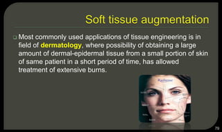  Most commonly used applications of tissue engineering is in
field of dermatology, where possibility of obtaining a large
amount of dermal-epidermal tissue from a small portion of skin
of same patient in a short period of time, has allowed
treatment of extensive burns.
79
 