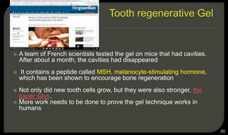 
 A team of French scientists tested the gel on mice that had cavities.
After about a month, the cavities had disappeared
 It contains a peptide called MSH, melanocyte-stimulating hormone,
which has been shown to encourage bone regeneration
 Not only did new tooth cells grow, but they were also stronger, the
paper says.
 More work needs to be done to prove the gel technique works in
humans
80
 