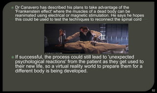  Dr Canavero has described his plans to take advantage of the
'Frankenstein effect' where the muscles of a dead body can be
reanimated using electrical or magnetic stimulation. He says he hopes
this could be used to test the techniques to reconnect the spinal cord
 If successful, the process could still lead to 'unexpected
psychological reactions' from the patient as they get used to
their new life, so a virtual reality world to prepare them for a
different body is being developed.
82
 