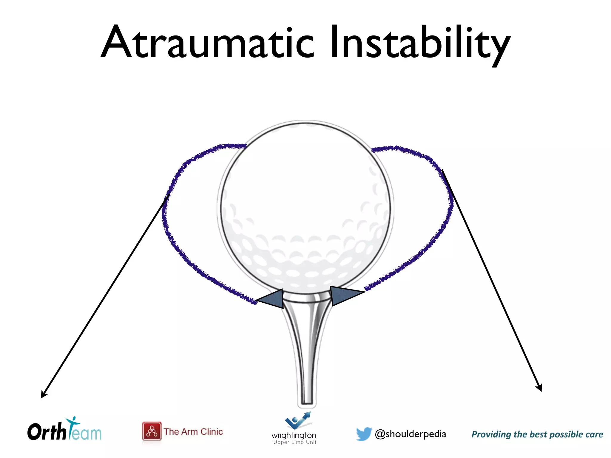 Providing)the)best)possible)care!@shoulderpedia
Atraumatic Instability
 