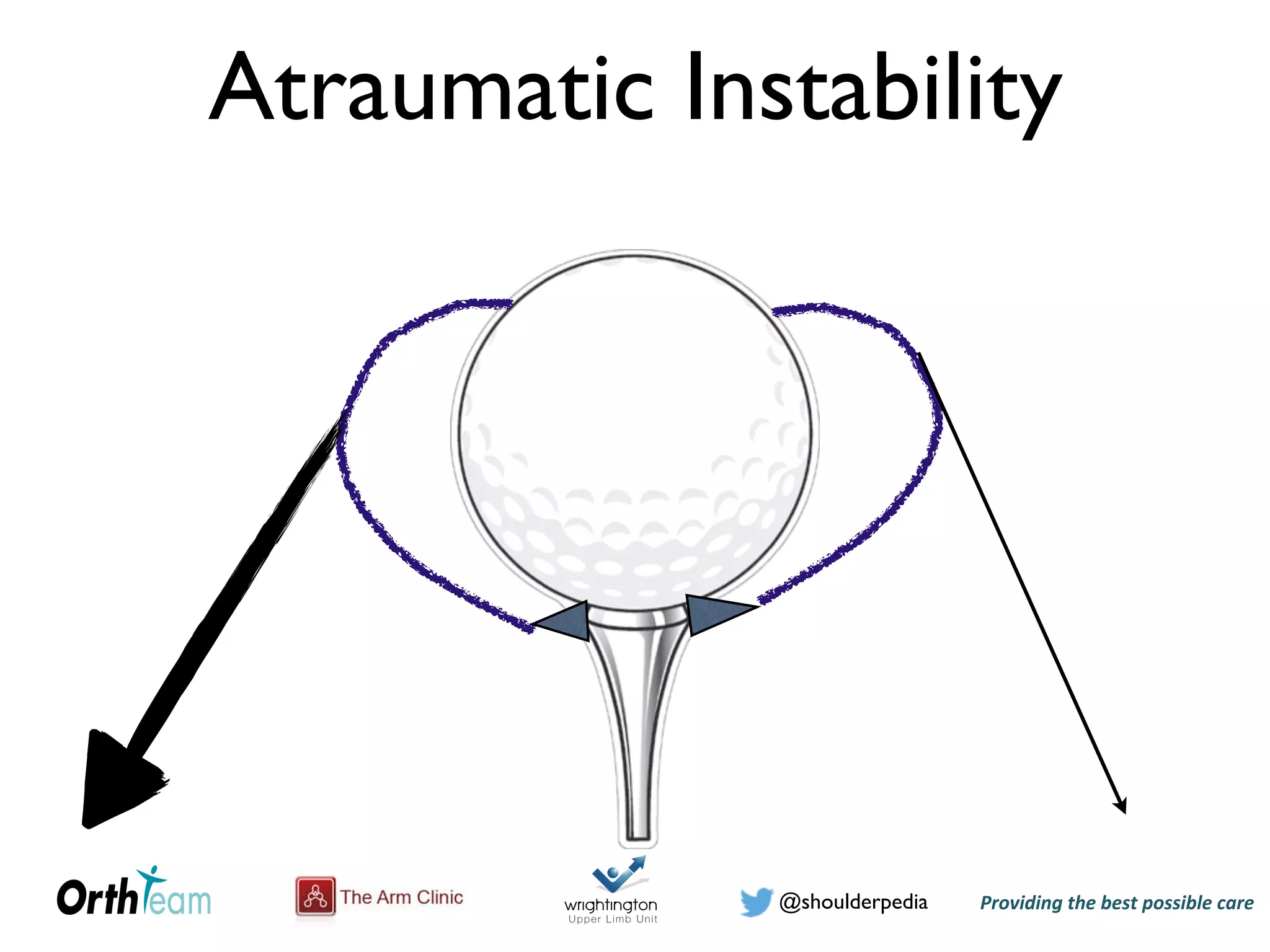 Providing)the)best)possible)care!@shoulderpedia
Atraumatic Instability
 