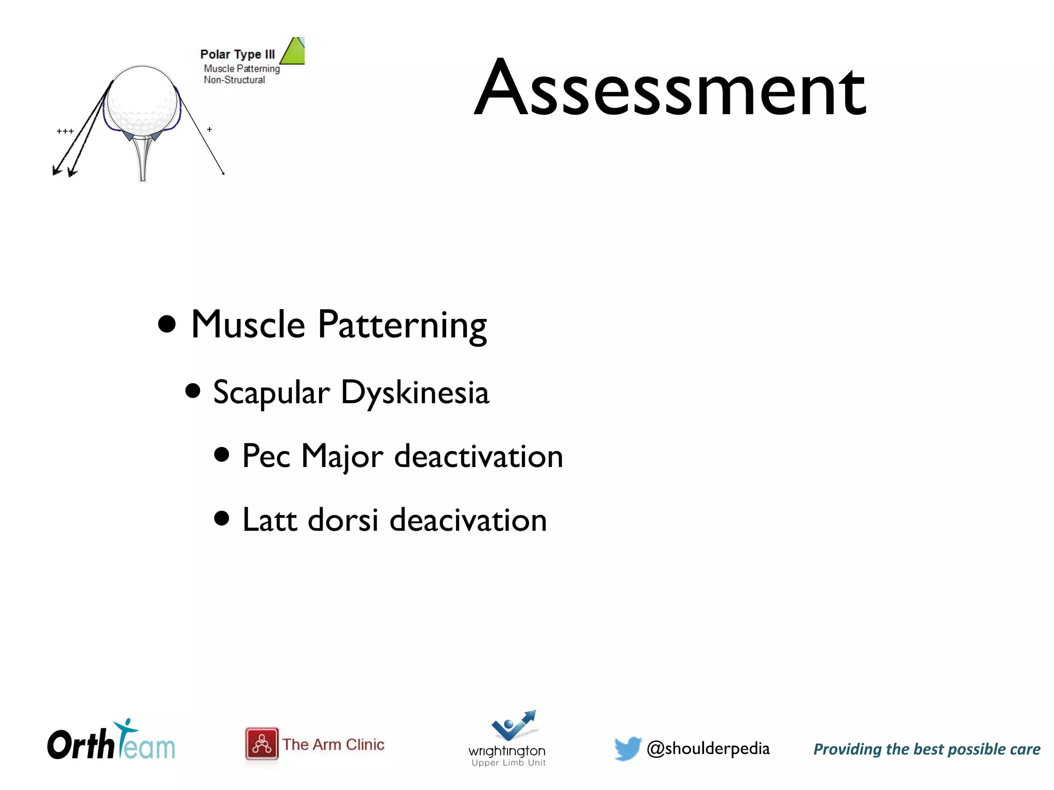 Providing)the)best)possible)care!@shoulderpedia
Assessment
• Muscle Patterning
• Scapular Dyskinesia
• Pec Major deactivation
• Latt dorsi deacivation
@shoulderpedia Puneet Monga
Atraumatic Instability
Tuesday, 24 May 16
+++ +
Tuesday, 24 May 16
! "$!
It is apparent from the above discussion that the presentation of patients with instability
can vary significantly and hence for the purposes of this study only patients with
recurrent anterior glenohumeral dislocations following a traumatic episode were
included.
Treatment of traumatic anterior shoulder dislocation may range from initial
immobilization followed by rehabilitation to early operative stabilization. The patient’s
age, previous dislocations, joint laxity, co-morbidities, compliance and activity level
guide the choice of treatment. It is common practice to reserve surgical treatment for
patients having recurrent dislocations. Non-operative management generally involves an
initial reduction of the dislocation followed by immobilization of the shoulder for a
period of three to six weeks. This is followed by physiotherapy focusing initially on
regaining the range of motion and then subscapularis strengthening exercises {O'Brien
et al., 1987}. However, 66% of those between 12 to 22 years of age have a recurrence
of dislocation {Hovelius et al., 1996}.
In the past, tendon or muscle units were shortened to stabilize the shoulder. For
example, the Putti-Platt procedure involved surgical shortening of the subscapularis to
achieve stability. This however led to a loss of movement, especially external rotation,
Tuesday, 24 May 16
, 24 May 16
 