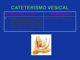 CATETERISMO VESICAL Procedimiento (Acción) Justificación Exponga el meato uretral. Si es mujer separe la vulva con dedos pulgar e índice sobre los labios mayores, si es hombre el pene se sostiene con los dedos medio y anular y el glande y el prepucio se retraen con los dedos índice y pulgar  Permite visualizar el orificio uretral. 