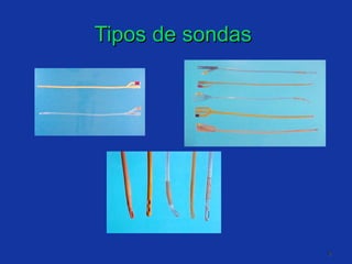 Tipos de sondas  