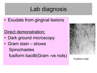 Borrelia | PPT