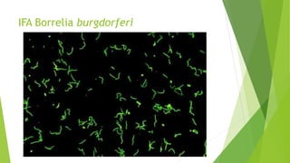 IFA Borrelia burgdorferi
 