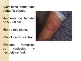 •Comienza como una
pequeña pápula.

•Aumenta de tamaño
de 5 – 50 cm.

•Borde rojo plano.

•Decoloración central.

•Eritema,   formación
de     vesículas    y
necrosis central.
 