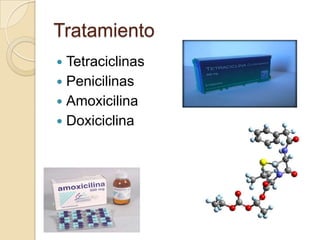 Tratamiento
 Tetraciclinas
 Penicilinas
 Amoxicilina
 Doxiciclina
 