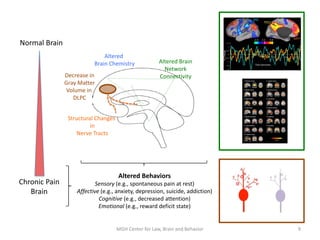 9
Decrease in
Gray Matter
Volume in
DLPC
Altered Brain
Network
Connectivity
Structural Changes
in
Nerve Tracts
Altered
Brain Chemistry
Normal Brain
Chronic Pain
Brain
Altered Behaviors
Sensory (e.g., spontaneous pain at rest)
Affective (e.g., anxiety, depression, suicide, addiction)
Cognitive (e.g., decreased attention)
Emotional (e.g., reward deficit state)
MGH Center for Law, Brain and Behavior
 