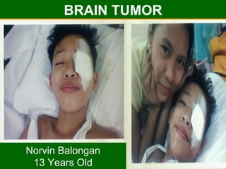 BRAIN TUMOR Norvin Balongan 13 Years Old 