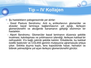 Tip – IV Kollajen

 Şu hastalıkların patogenezinde yer alırlar:
 - Good Pasture Sendromu: Anti α3 antikorlarının glomerüler ve
  alveoler bazal laminaya bağlanmasının yol açtığı, ilerleyen
  glomerülonefrit ve akciğerde kanamanın geliştiği otoimmün bir
  hastalıktır.
 - Alport Sendromu: Glomerüler bazal laminanın düzensiz şekilde
  incelmesi, kalınlaşması ve yırtılmasının izlendiği, ilerleyen kalıtsal bir
  nefropatidir. X’e bağlı çekinik şekilde kalıtılır. Erkeklerde, bu kalıtsal
  özellik baskındır ve COL4A5 geninin mutasyona uğramasıyla ortaya
  çıkar. Sıklıkla duyma kaybı, lens kapsülünde hasar, hematüri ve
  böbrek yetmezliğine yol açan ilerleyici glomerülonefrit görülür.
 