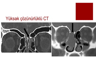 Yks k ??znrlkl CT?
 