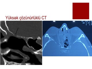 Yks k ??znrlkl CT?
 