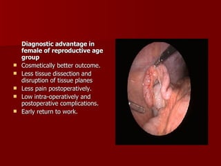 Diagnostic advantage in female of reproductive age group Cosmetically better outcome. Less tissue dissection and disruption of tissue planes Less pain postoperatively. Low intra-operatively and postoperative complications. Early return to work. 
