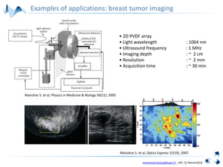 emmanuel.bossy@espci.fr , IHP, 12 février2014
Manohar S. et al, Optics Express 15(19), 2007
Manohar S. et al, Physics in Medicine & Biology 50(11), 2005
• 2D PVDF array
• Light wavelength : 1064 nm
• Ultrasound frequency : 1 MHz
• Imaging depth : ~ 2 cm
• Resolution : ~ 2 mm
• Acquisition time : ~ 30 min
Examples of applications: breast tumor imaging
 