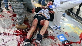 A victim is helped on the sidewalk of Boylston
Street. (John Tlumacki/Globe Staff)#
April 24, 2013 19
 