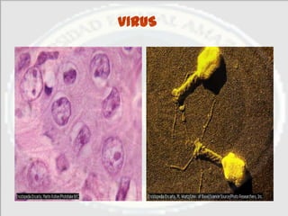 VIRUS
 