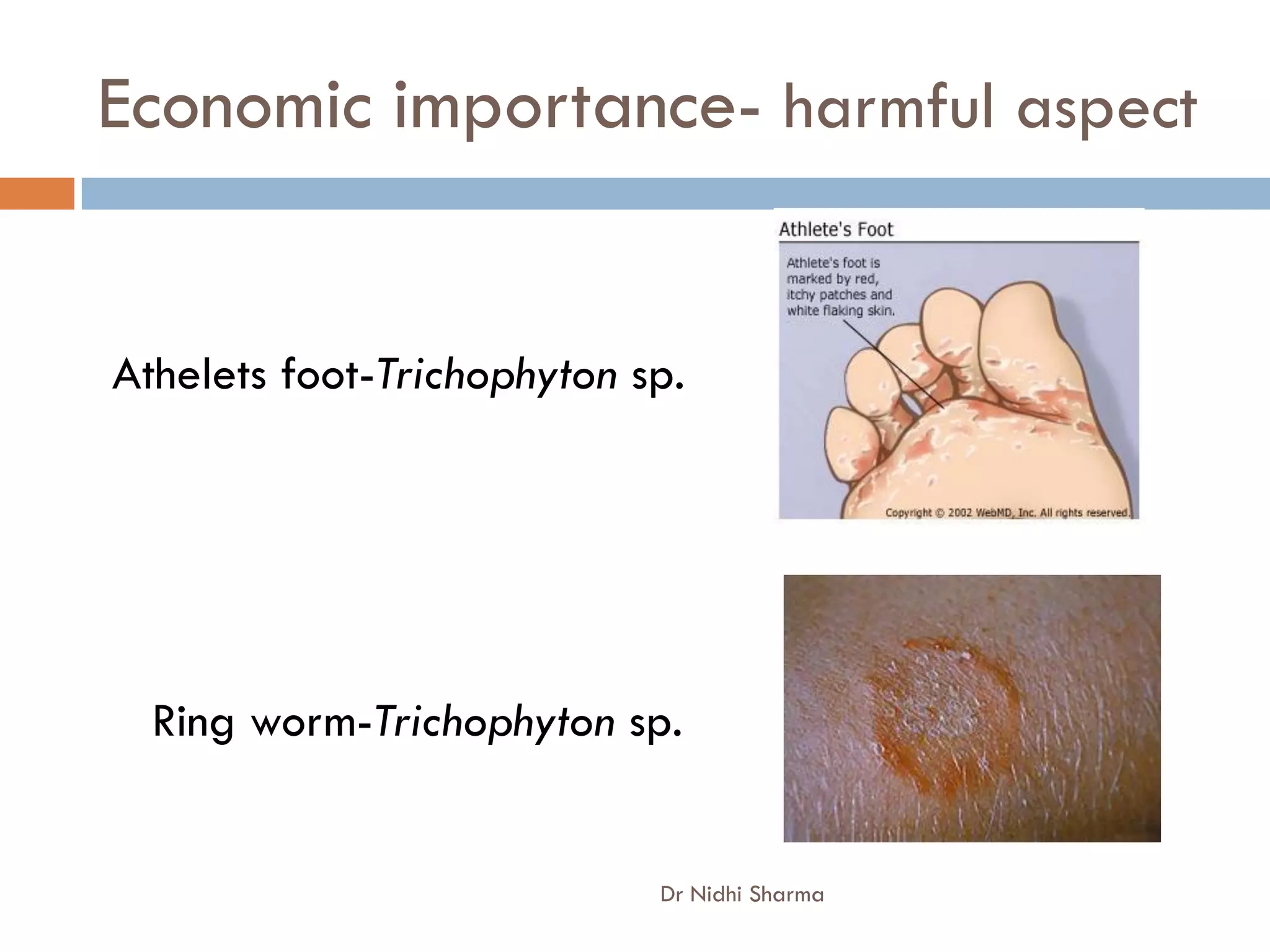 Economic importance- harmful aspect


Athelets foot-Trichophyton sp.




  Ring worm-Trichophyton sp.


                            Dr Nidhi Sharma
 
