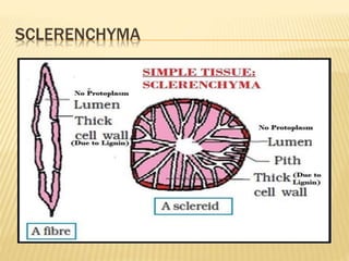 SCLERENCHYMA
 