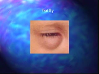 botfly 