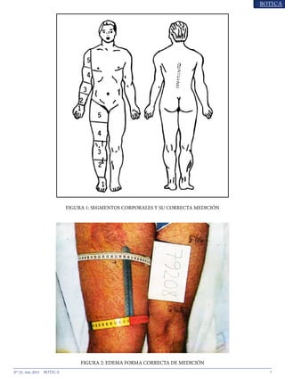 7N° 33, Año 2015
FIGURA 1: SEGMENTOS CORPORALES Y SU CORRECTA MEDICIÓN
FIGURA 2: EDEMA FORMA CORRECTA DE MEDICIÓN
 