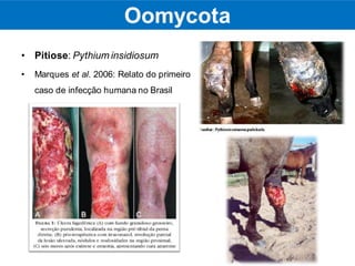 • Pitiose: Pythium insidiosum
• Marques et al. 2006: Relato do primeiro
caso de infecção humana no Brasil
Oomycota
 