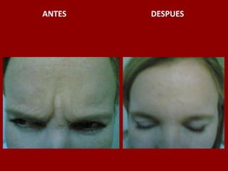 ANTES                                          DESPUES