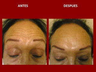 ANTES                                          DESPUES