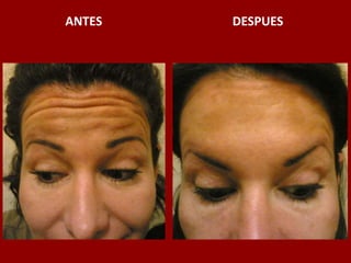ANTES                                          DESPUES