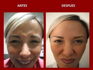 ANTES                                          DESPUES