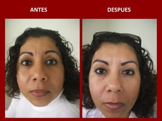 ANTES                                          DESPUES