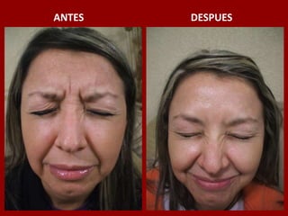 ANTES                                          DESPUES