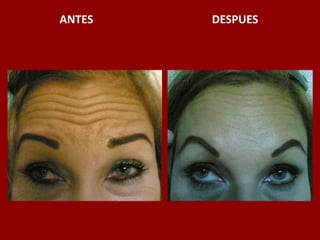 ANTES                                          DESPUES