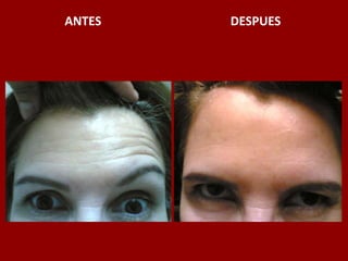 ANTES                                          DESPUES